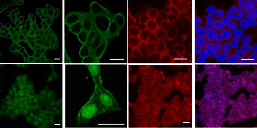 Artículo tamoxifeno