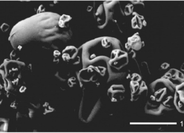 Resveratrol Delivery Systems