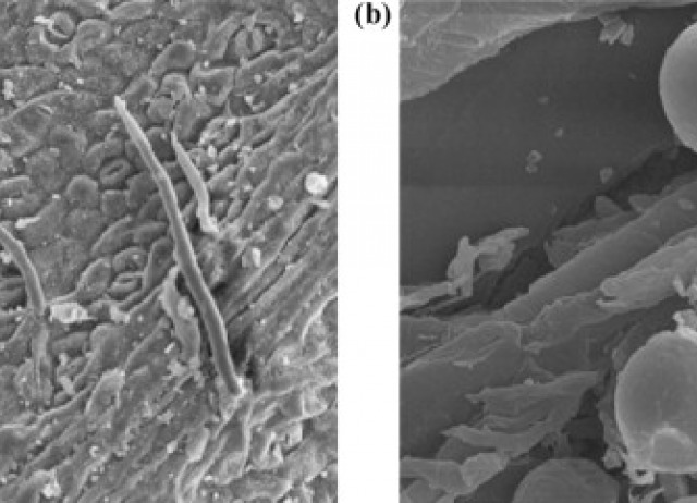 Supercritical CO2 extraction of Persea