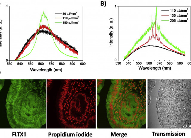 Opto-chemical and laser properties of FLTX1, a novel fluorescent tamoxifen derivative, and its potential applications in breast cancer photodynamic chemotherapy