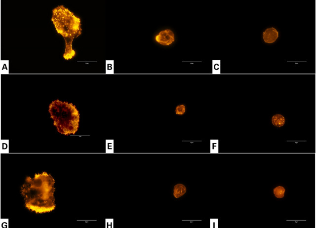 Gongolarones as antiamoeboid chemical scaffold